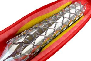 Jordi Labs specializes in E&L testing for medical devices