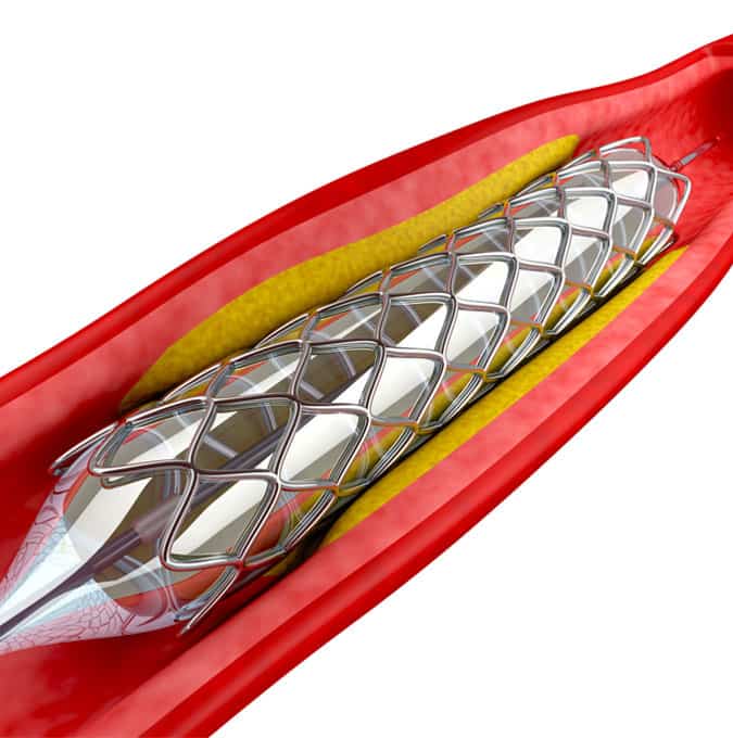 Jordi Labs specializes in E&L testing for medical devices