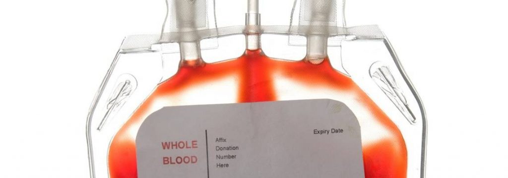 Image of blood bag for analysis on a single use bioprocess system.